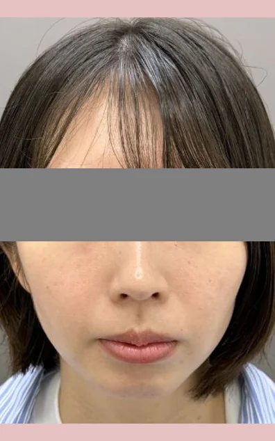 (1)症例