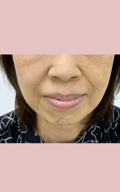 (11)症例