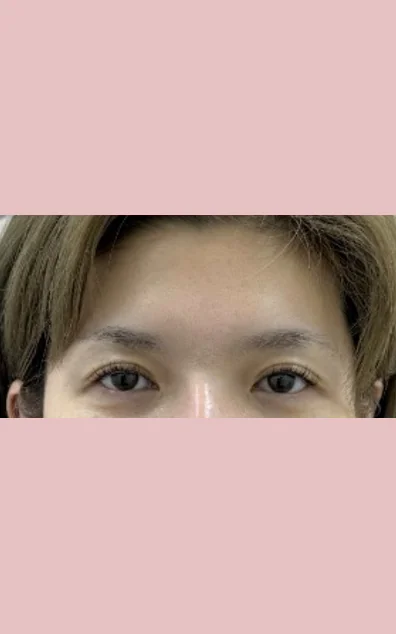 (12)症例