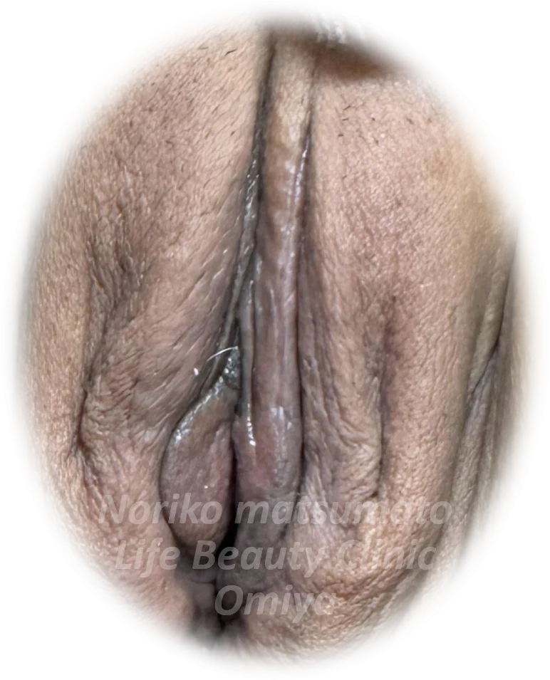 症例186（アフター）